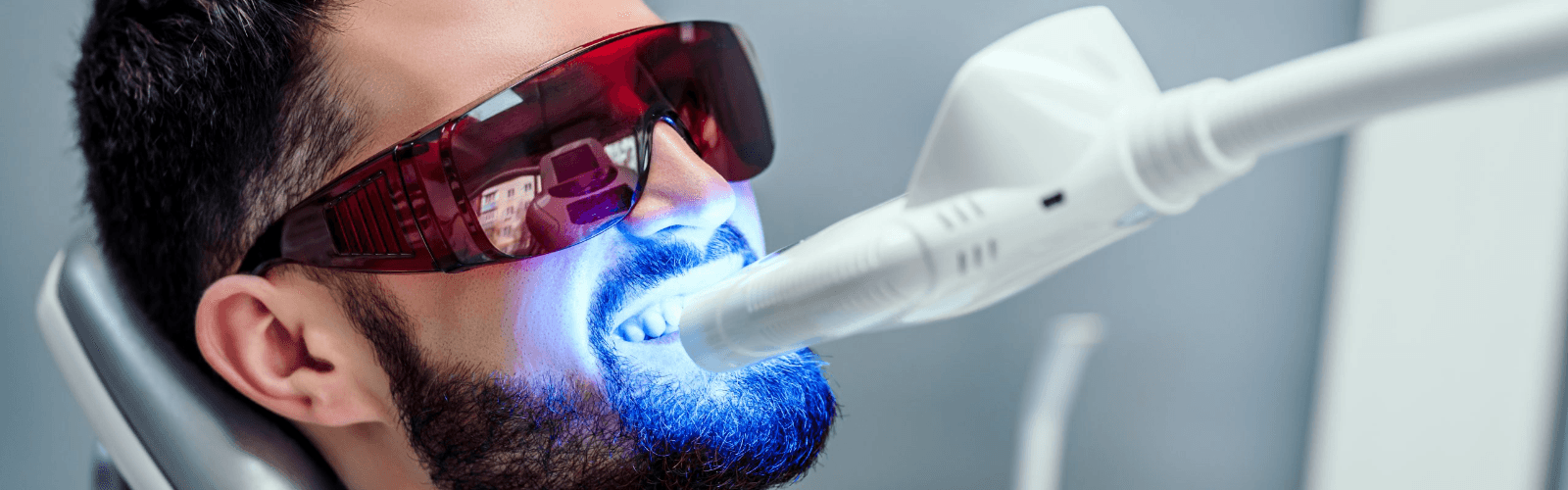 teeth whitening services ibiza